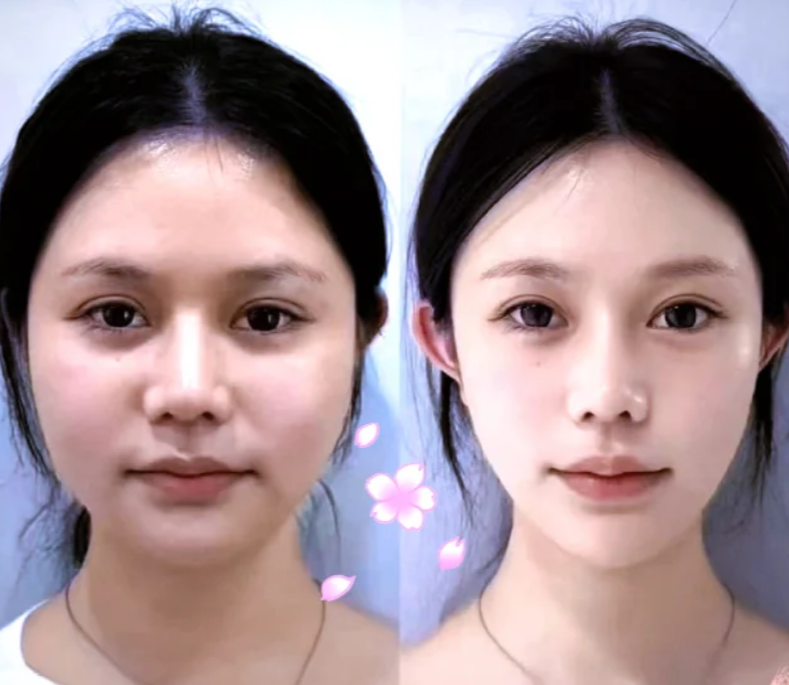 五、石膏线与石膏板双眼皮吊顶的尺寸差异