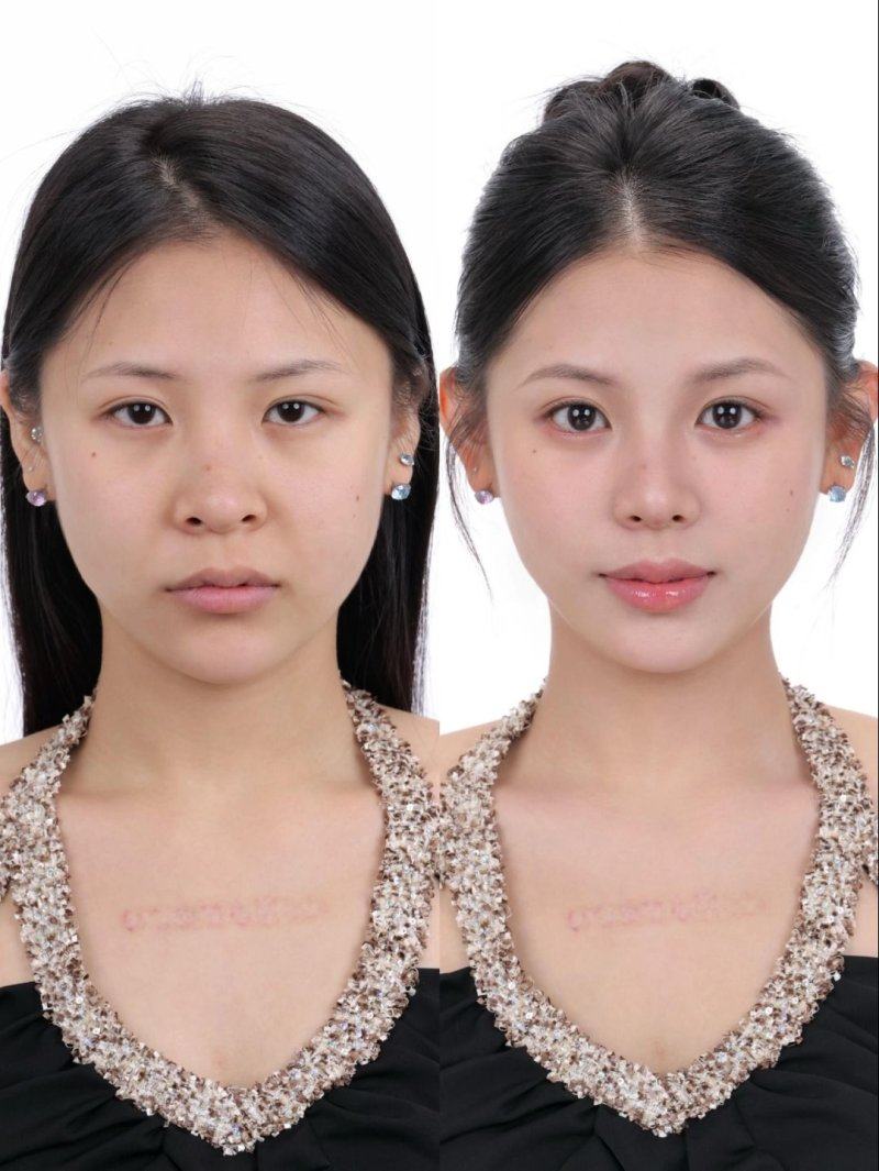 深圳锦瑄医疗美容诊所擅长项目：