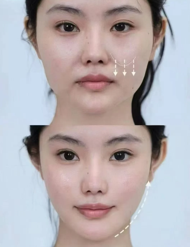 五、疤痕增生后的应对方法