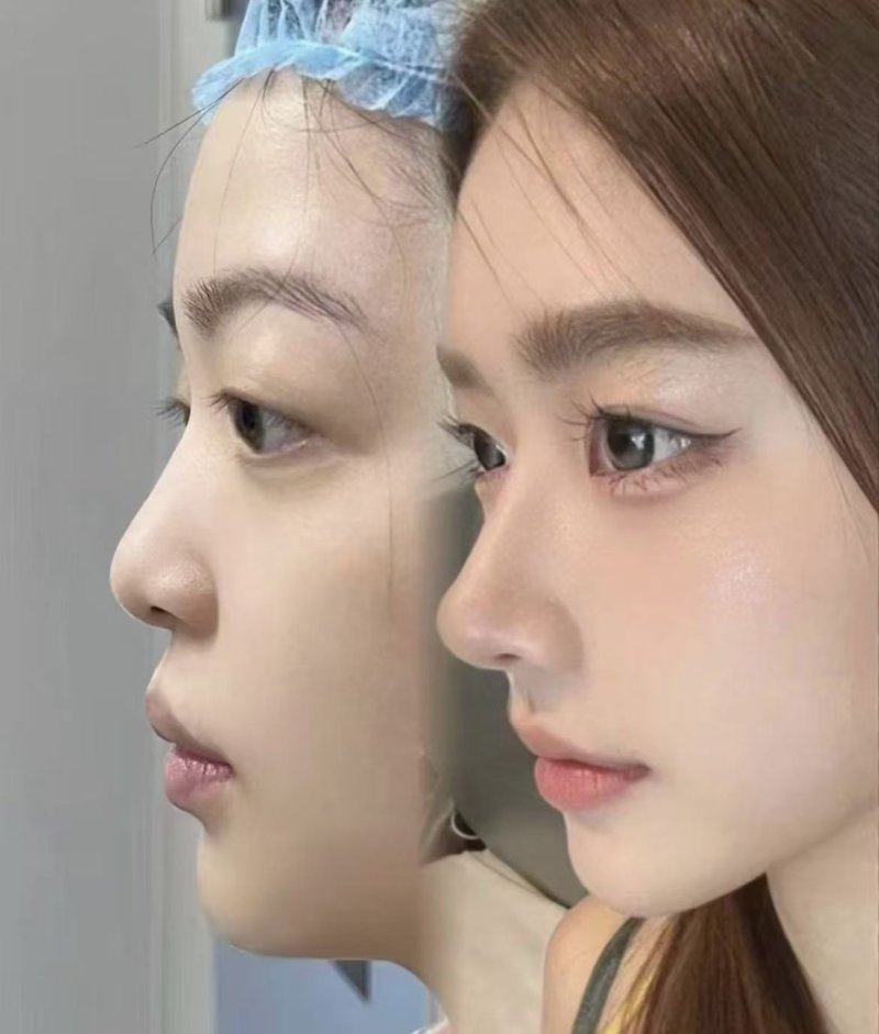 深圳锦瑄医疗美容诊所医生名单及擅长领域：