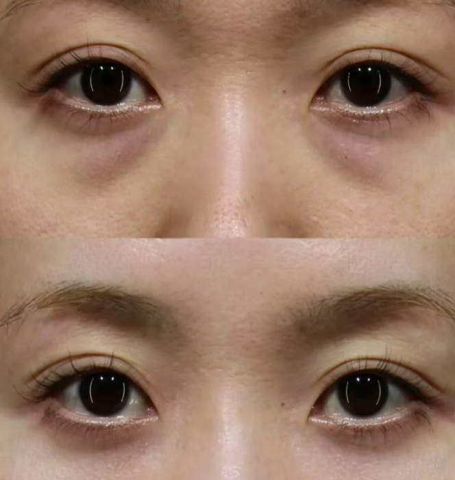 天津妍颜美医疗美容诊所擅长项目: