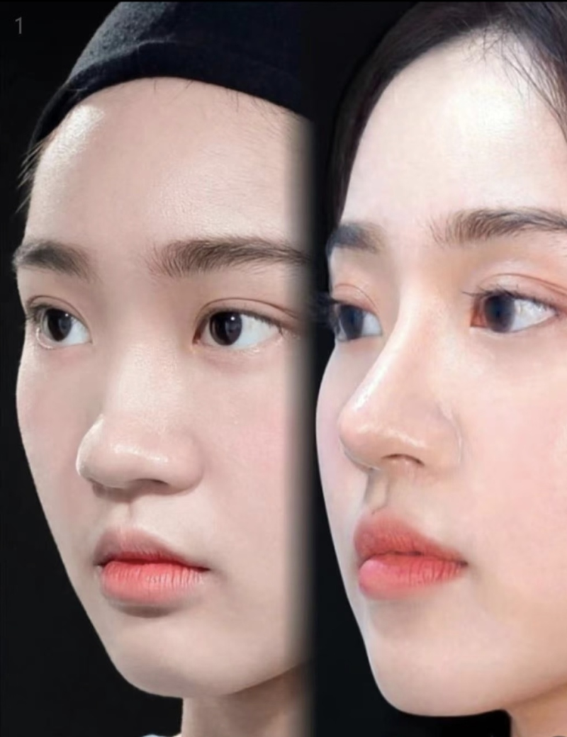 上海美仑医疗美容门诊部怎么样？