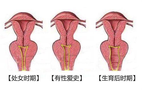 五、疤痕植发的价格参考