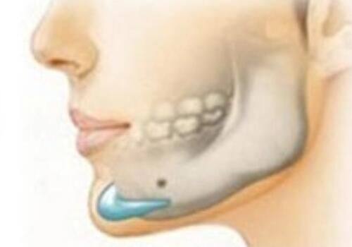 二、疤痕增生凸起对外观与心理的双重打击