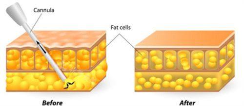 三、损害皮肤功能，干扰正常生活节奏