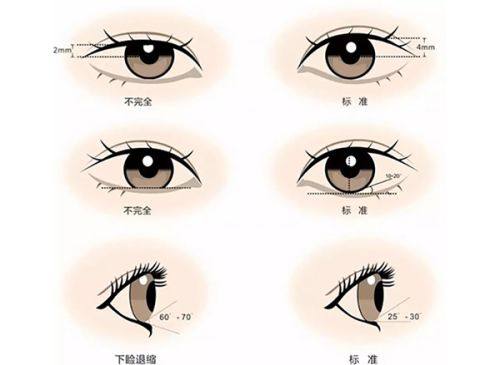 三、菲利普林果冻针注射鼻基底隆鼻的时间特点