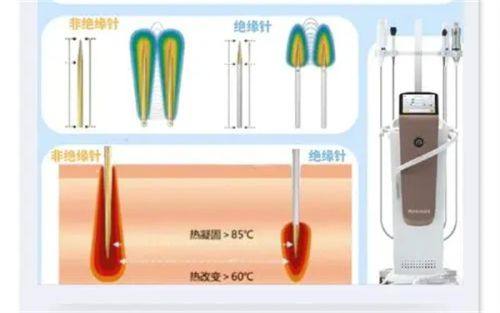 韩国Roi整形外科口碑评价：