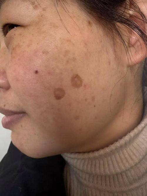 广州立美华粤医疗美容门诊部预约挂号方式