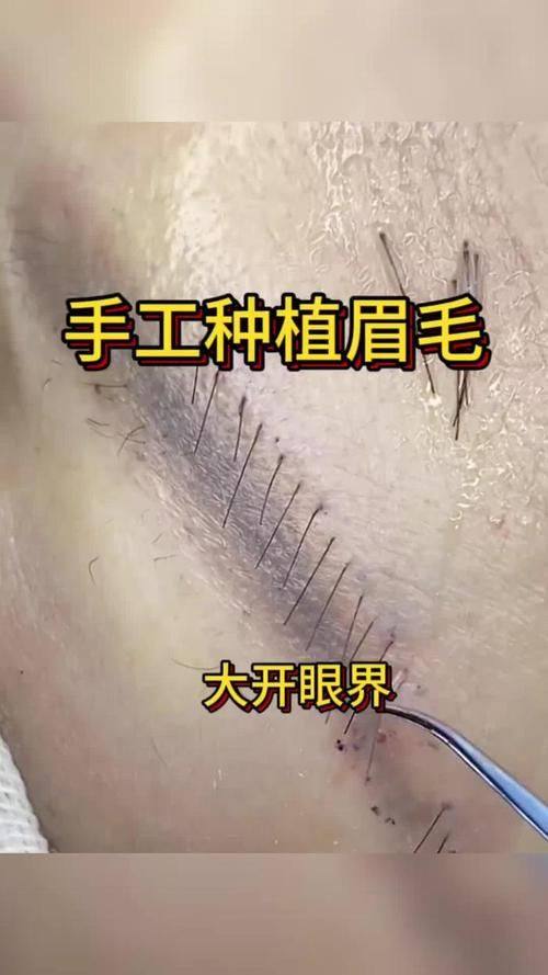 广州立美华粤医疗美容门诊部医生名单及擅长领域