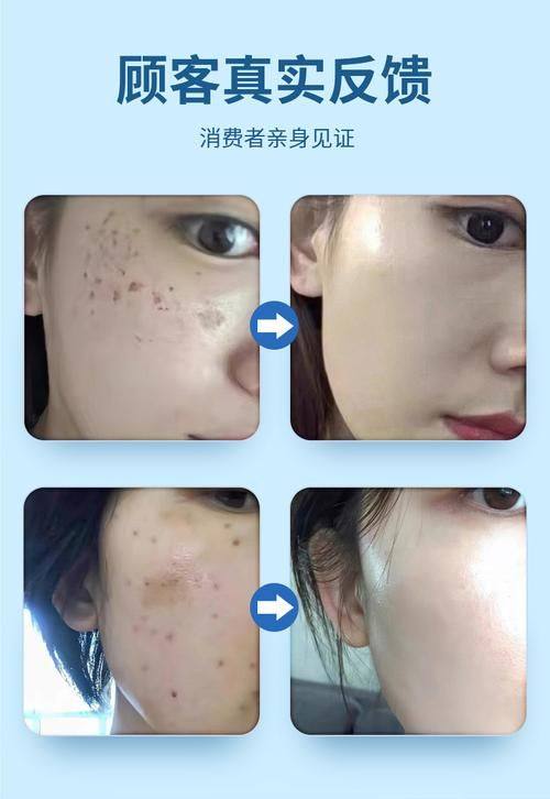 长春光泽爱丽医疗美容门诊部价格表