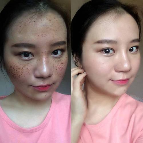 泉州闽海皮肤病医院怎么样?