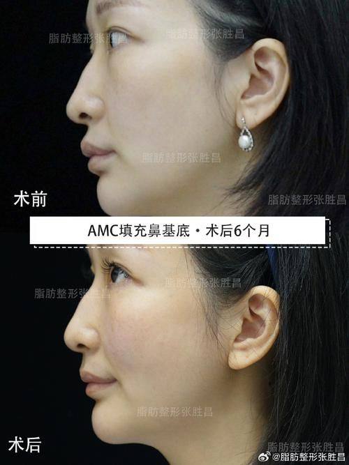 广州立美华粤医疗美容门诊部价格表