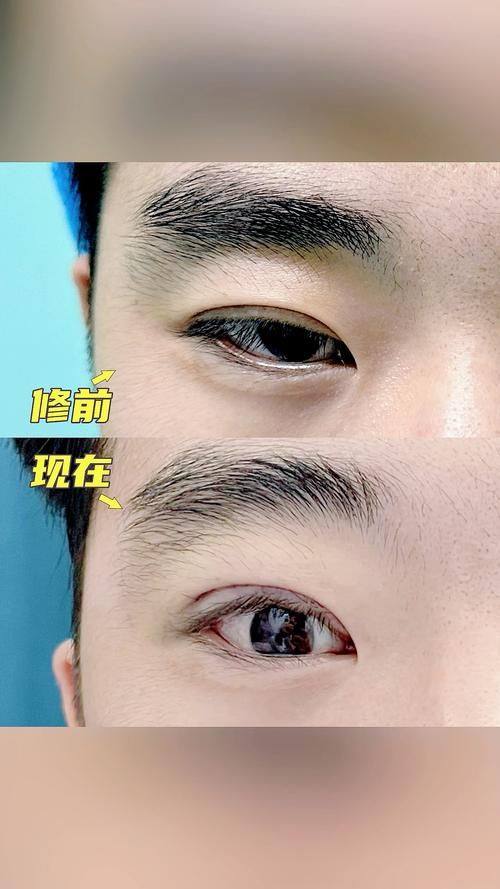 韩国Roi整形外科擅长项目：