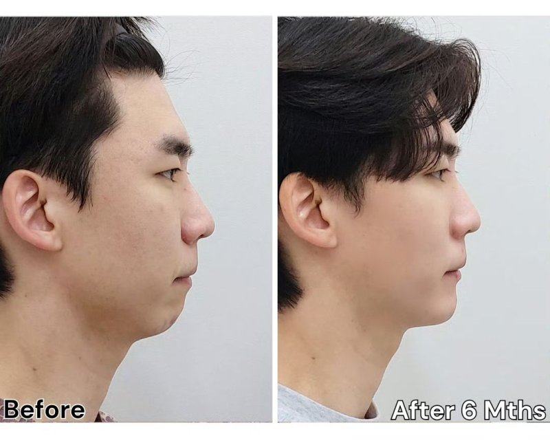 四、选对修复方案，找对专精医生是关键