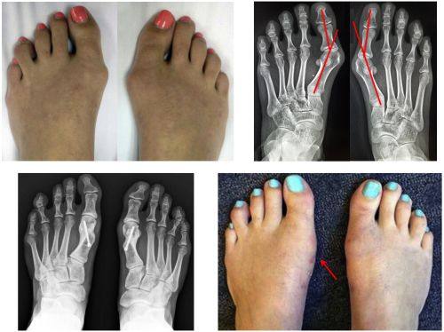 四、各地华美眼袋手术修复与费用的地域差异