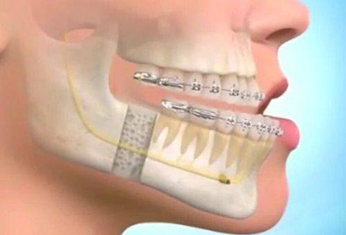 上海首尔丽格医疗美容擅长项目：