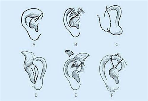 三、病理性眼袋青色的潜在健康信号