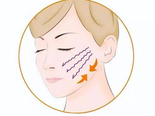 五、怎么选去眼袋方法？牢记3个核心原则