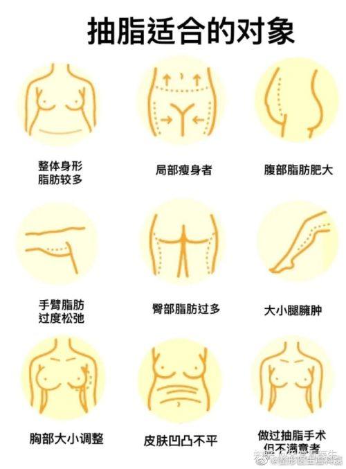 三、年轻群体轻微松弛三角眼的精细化设计要点