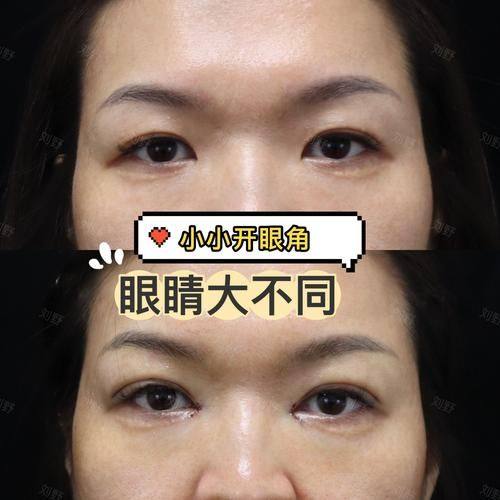 长沙亚太美容整形医院医生名单及擅长领域：