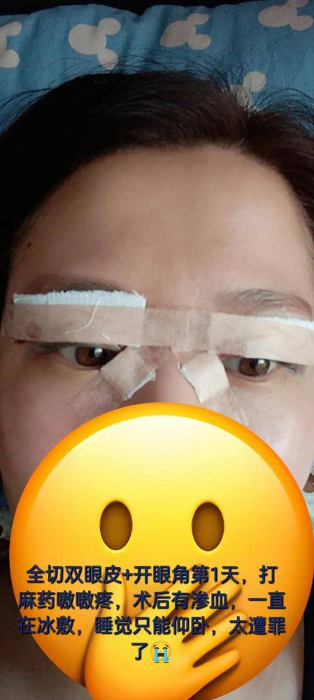 长沙亚太美容整形医院怎么样？