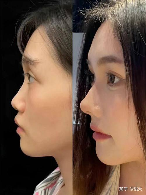 长沙亚太美容整形医院口碑评价：