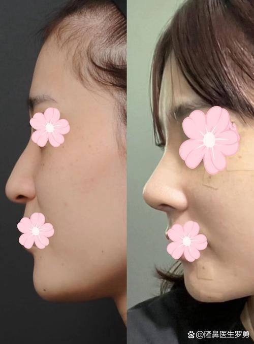 广东东莞九分美医疗美容价格表：