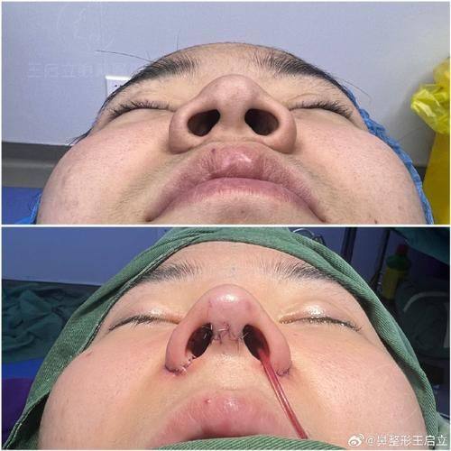 天津南开怡丽亚韩整形美容医院地址电话及营业时间