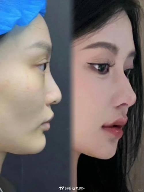 韩国A特整形外科医院地址电话及营业时间