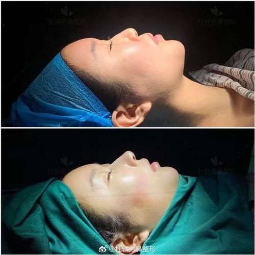 韩国A特整形外科医院价格表