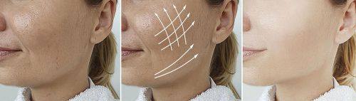 韩国A特整形外科医院怎么样？