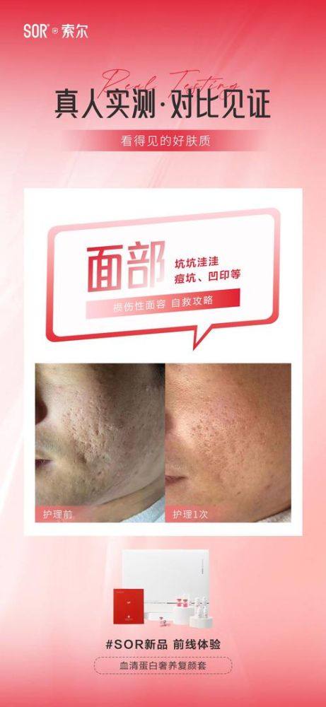 上海首尔丽格医疗美容怎么样？