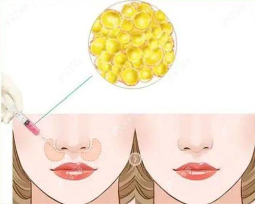 赣州伊丽汇医疗美容门诊部怎么样？