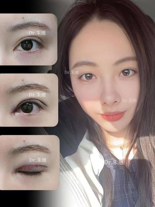 天津南开怡丽亚韩整形美容医院价格表