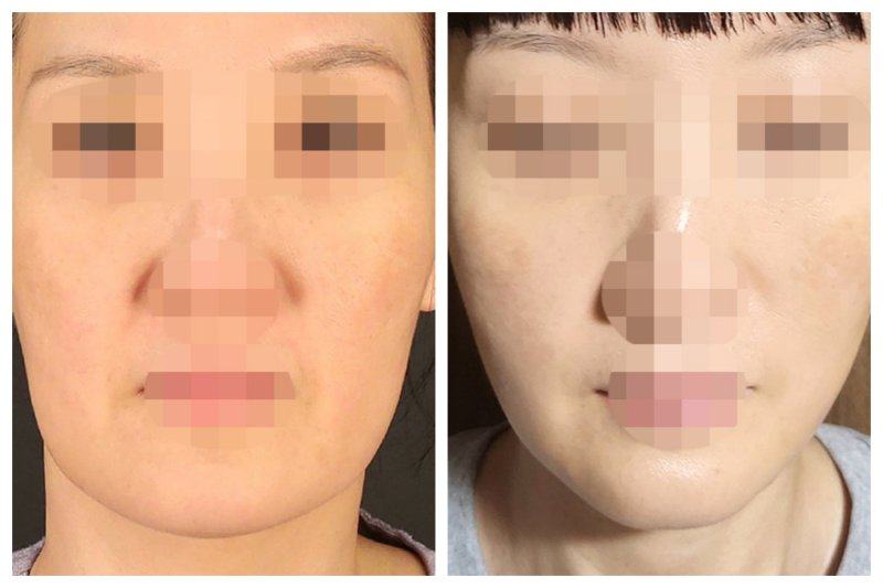 四、日常调护：改善孩子眼袋青色的实用方法