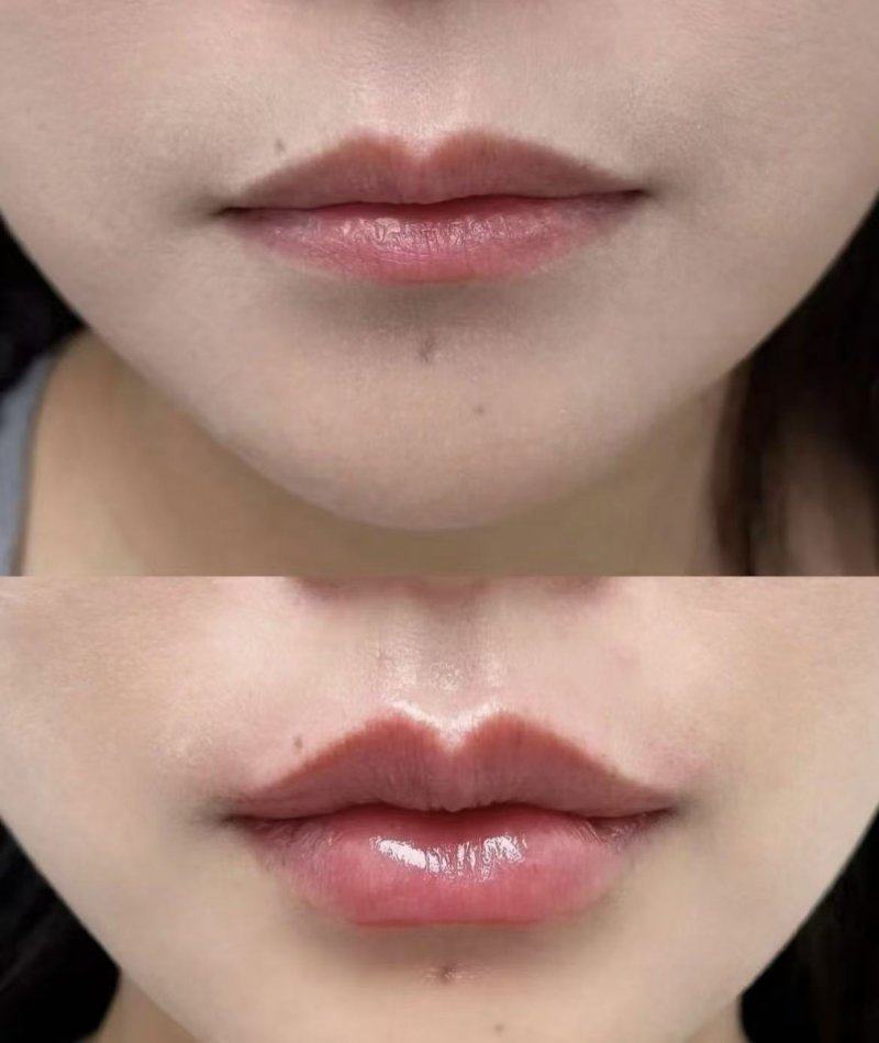 四、眼周日常通用护理妙招