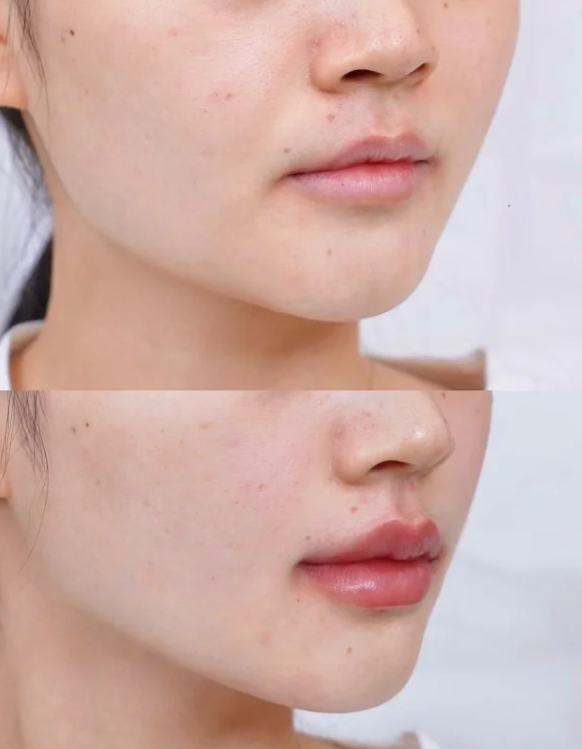 五、医生关于假体复查与更换的专精建议