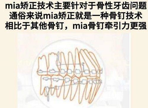 四、不同种植方法的选择逻辑