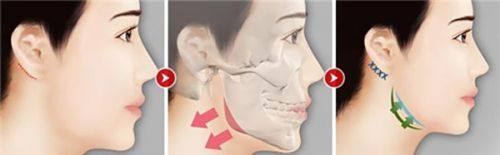 五、黑眼圈眼袋改善的睡眠调理要点有哪些?