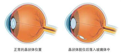 五、种植技术的共性优势与注意事项