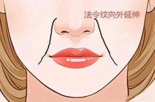 二、常见术后后遗症:形态与位置异常