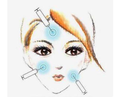 二、双眼皮祛疤膏一般要擦多久才好