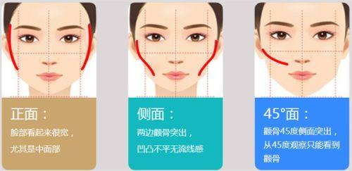 三、改良型埋线双眼皮：技术升级，维持时长可达20年