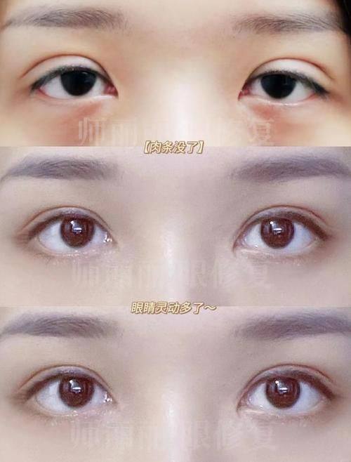 徐州美特莱斯医疗美容医院价格表：