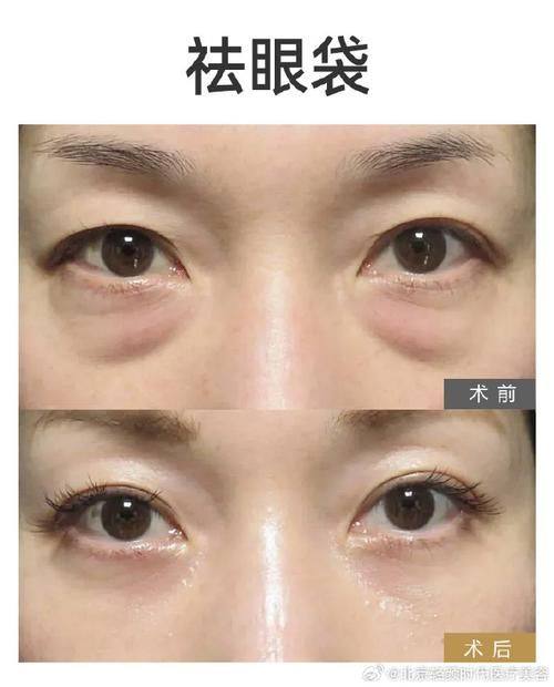 广州慕兰医疗美容门诊部口碑评价：