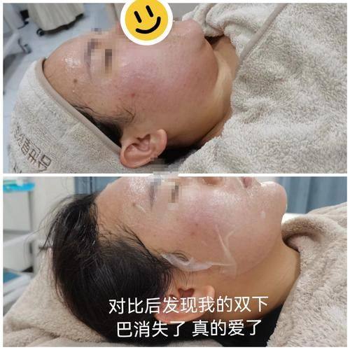 遂宁肤美皮肤医疗美容门诊部口碑评价：