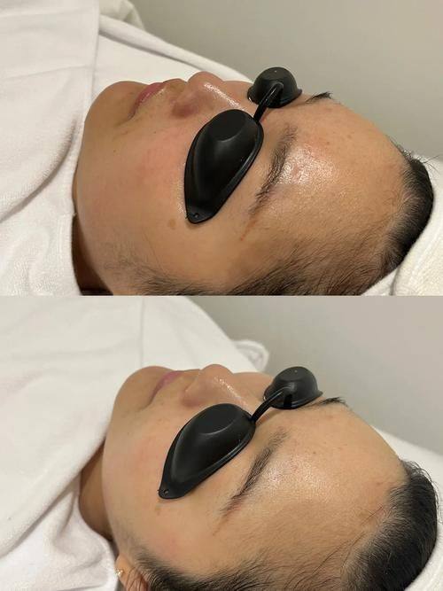 济宁玛格丽医疗美容诊所价格表：