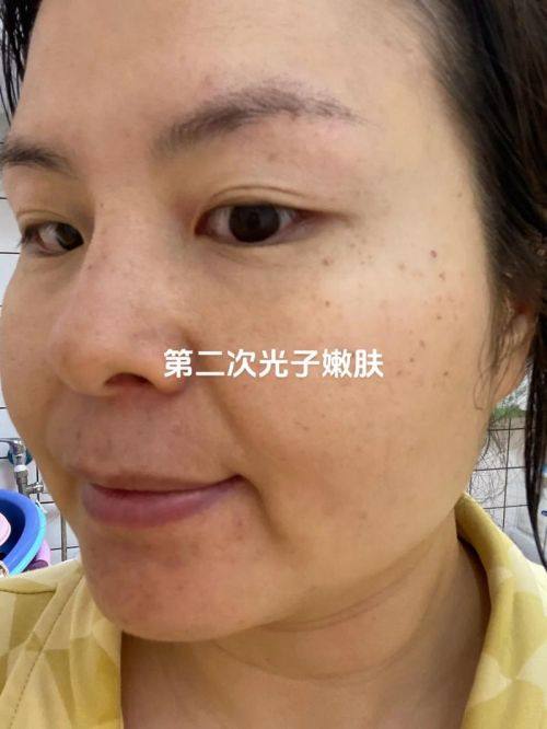 济宁玛格丽医疗美容诊所预约挂号方式：