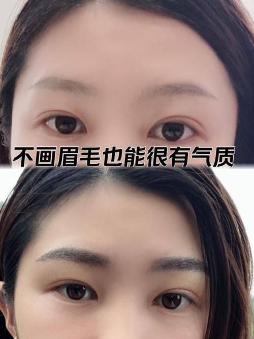 韩国狎鸥亭延世整形外科 