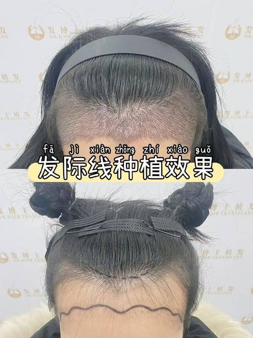 韩国狎鸥亭延世整形外科 